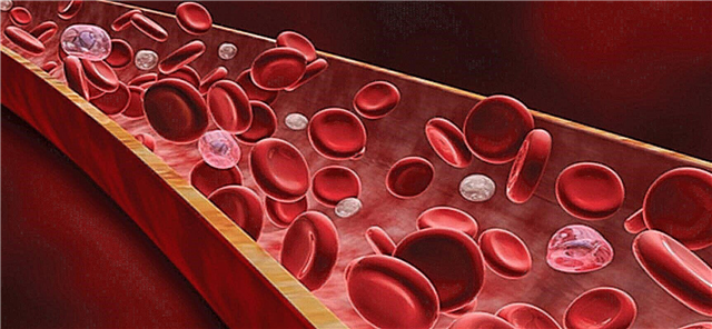 20 фактів про людської крові: відкриття груп, гемофілія і канібал в ефірі ВВС