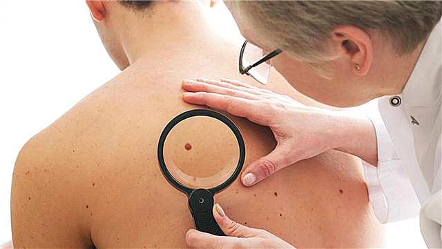 20 Fakten iwwer mënschlech Haut: Mol, Karotin, Melanin a falsch Kosmetik